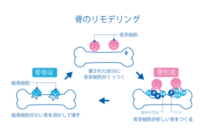 「骨折してから」では遅い？ 骨粗鬆症2025・最新ガイドラインで読み解く【後編】のアイキャッチ画像