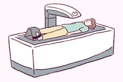 「骨折してから」では遅い？ 骨粗鬆症2025・最新ガイドラインで読み解く【前編】のアイキャッチ画像