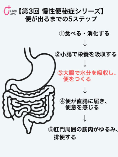 慢性便秘症シリーズ第3回。食べたものが消化・吸収され、大腸で便がつくられ、直腸に届いて便意を感じ、排便するまでの5つのステップを示した図
